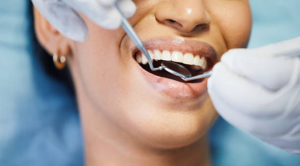 Best Emergency Treatment for Dental Infections or Abscesses in Gold Hill, OR